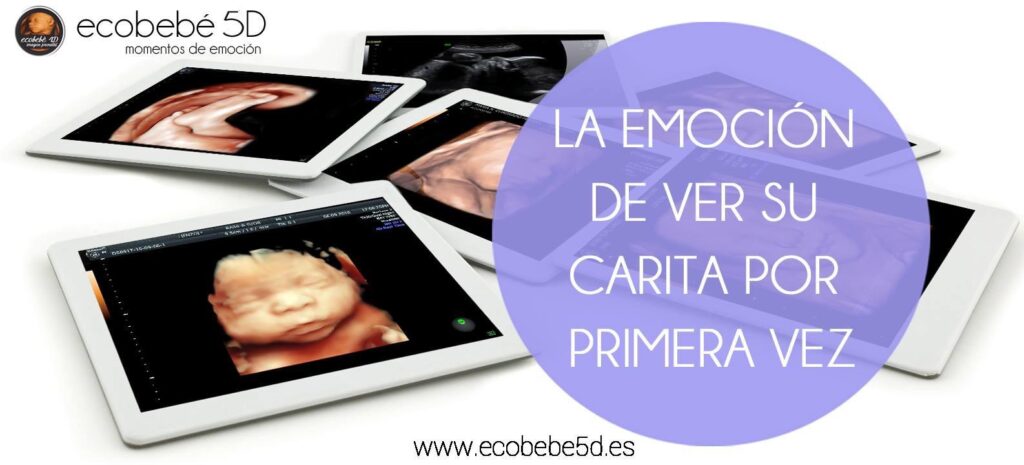 La Mejor Eco 5D