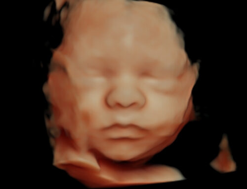 Ecografía 5D Terrassa