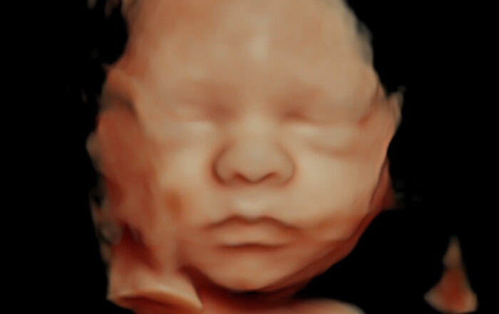 Ecografia 5D Terrassa